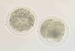 Twin embryos